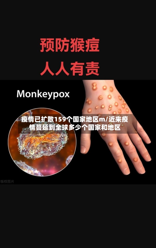 疫情已扩散159个国家地区m/近来疫情蔓延到全球多少个国家和地区